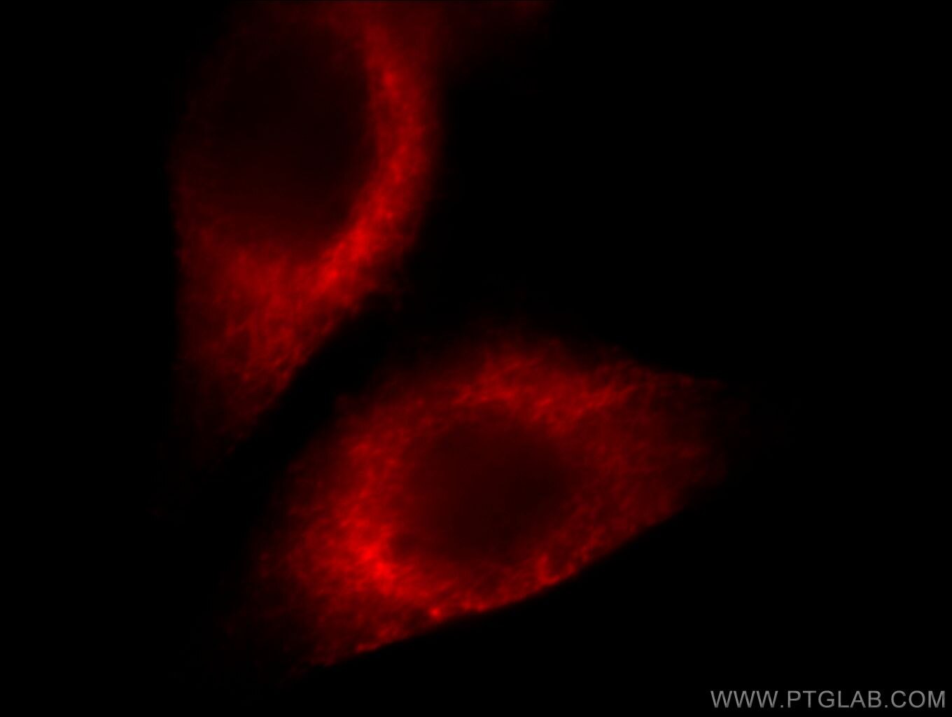 GMFB Immunofluorescence IF 60062-1-Ig GMFB Antibody GMF