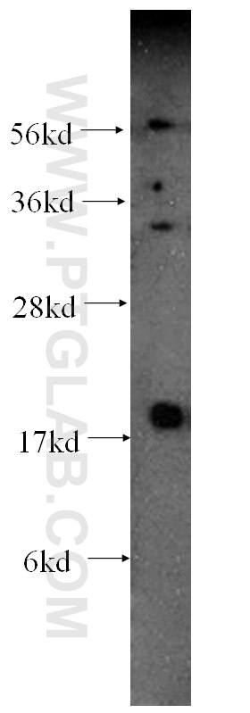 GMFB western blot WB 60062-1-Ig GMFB Antibody GMF