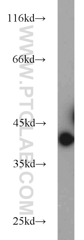 GNB5 western blot WB 11045-2-AP GNB5 Antibody FLJ37457; FLJ43714; GB5