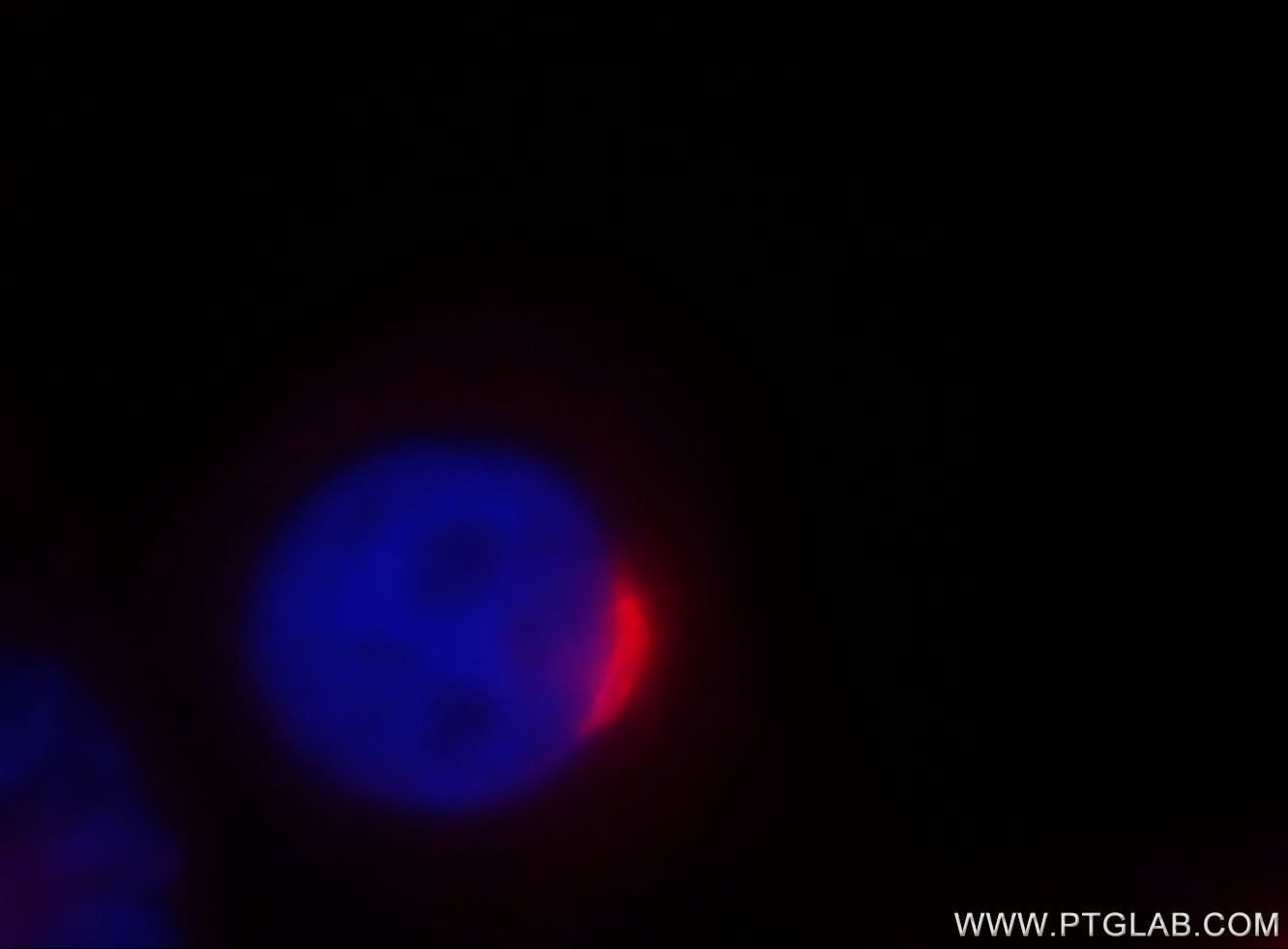 GOLM1 Immunofluorescence IF 15126-1-AP GOLM1 Antibody C9orf155; FLJ22634; FLJ23608; GOLPH2; GP73; PSEC0257; bA379P1.3