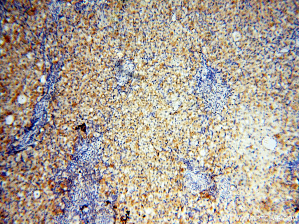 GPR177 IHC Immunohistochemical 17950-1-AP GPR177 Antibody C1orf139; EVI; FLJ23091; MGC131760; MGC14878; MRP; WLS