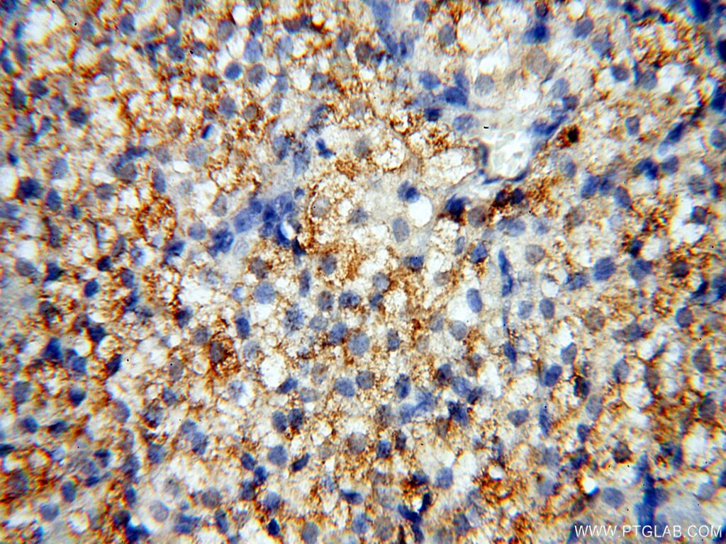 GPR177 IHC Immunohistochemical 17950-1-AP GPR177 Antibody C1orf139; EVI; FLJ23091; MGC131760; MGC14878; MRP; WLS