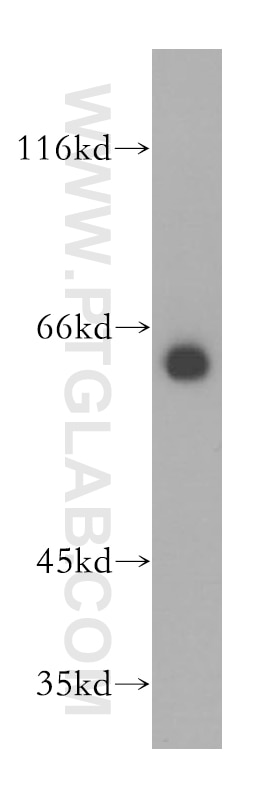 GPR177 western blot WB 17950-1-AP GPR177 Antibody C1orf139; EVI; FLJ23091; MGC131760; MGC14878; MRP; WLS