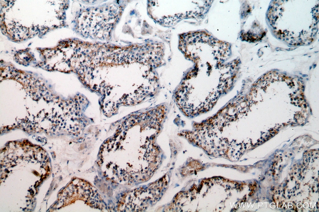 GPX5 IHC Immunohistochemical 18731-1-AP GPX5 Antibody 