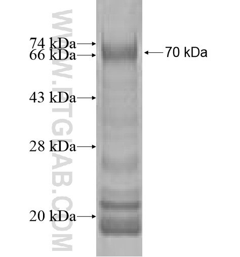 GRK6 fusion protein ag1992 SDS-PAGE