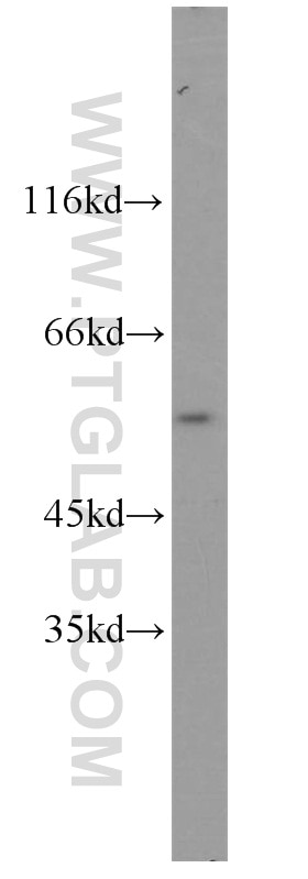 HEK-293 cells were subjected to SDS PAGE followed by western blot with 10354-1-AP(GRWD1 Antibody) at dilution of 1:500 GRWD1 western blot WB 10354-1-AP GRWD1 Antibody GRWD; KIAA1942; RRB1; WDR28
