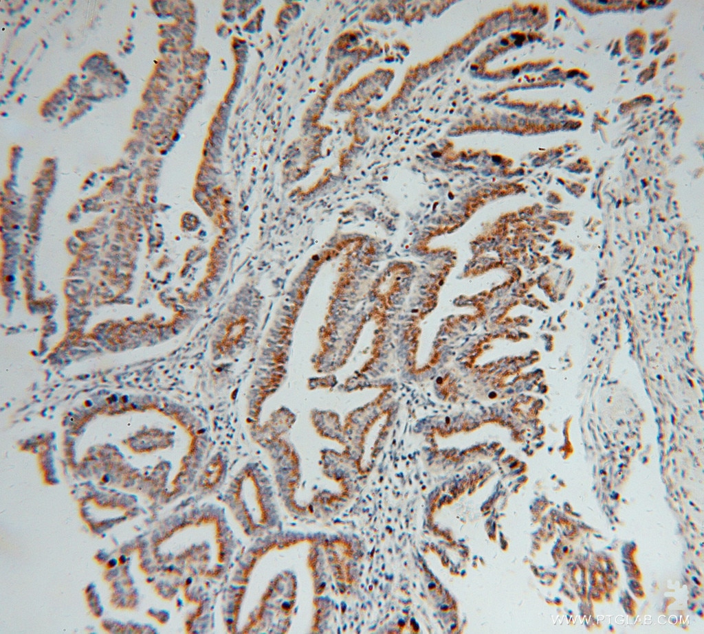GS28 IHC Immunohistochemical 16106-1-AP GS28 Antibody GOLIM2; GOS-28; GOS28; GOS28/P28; GS28; P28