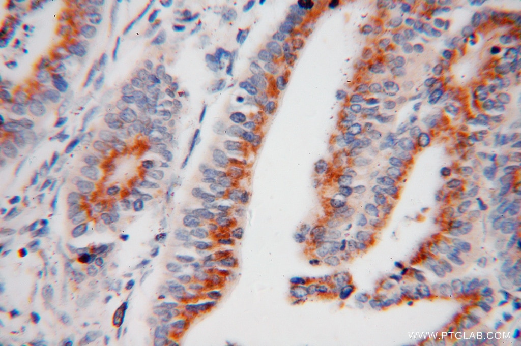 GS28 IHC Immunohistochemical 16106-1-AP GS28 Antibody GOLIM2; GOS-28; GOS28; GOS28/P28; GS28; P28