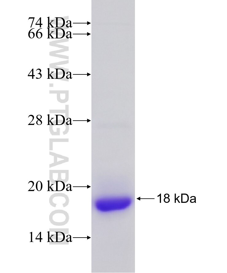 GSK3B fusion protein ag17320 SDS-PAGE