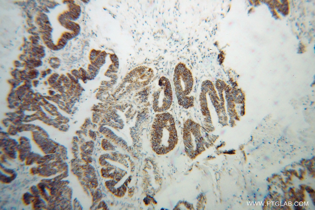 GSTK1 IHC Immunohistochemical 14535-1-AP GSTK1 Antibody GST; GST13; GST13-13; GSTK1-1