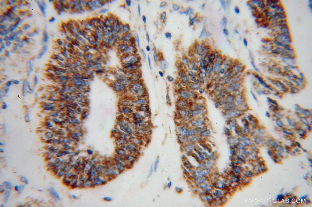 GSTK1 IHC Immunohistochemical 14535-1-AP GSTK1 Antibody GST; GST13; GST13-13; GSTK1-1