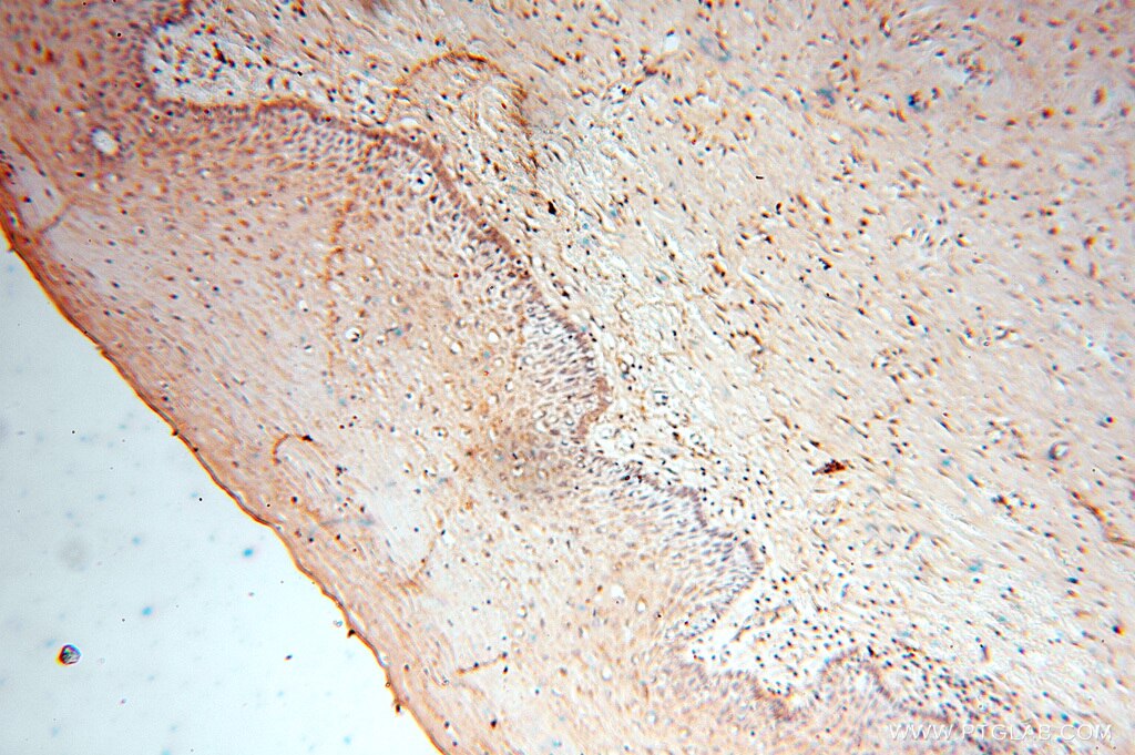 GSTM4 IHC Immunohistochemical 16766-1-AP GSTM4 Antibody GSTM4-4; GTM4; MGC131945; MGC9247