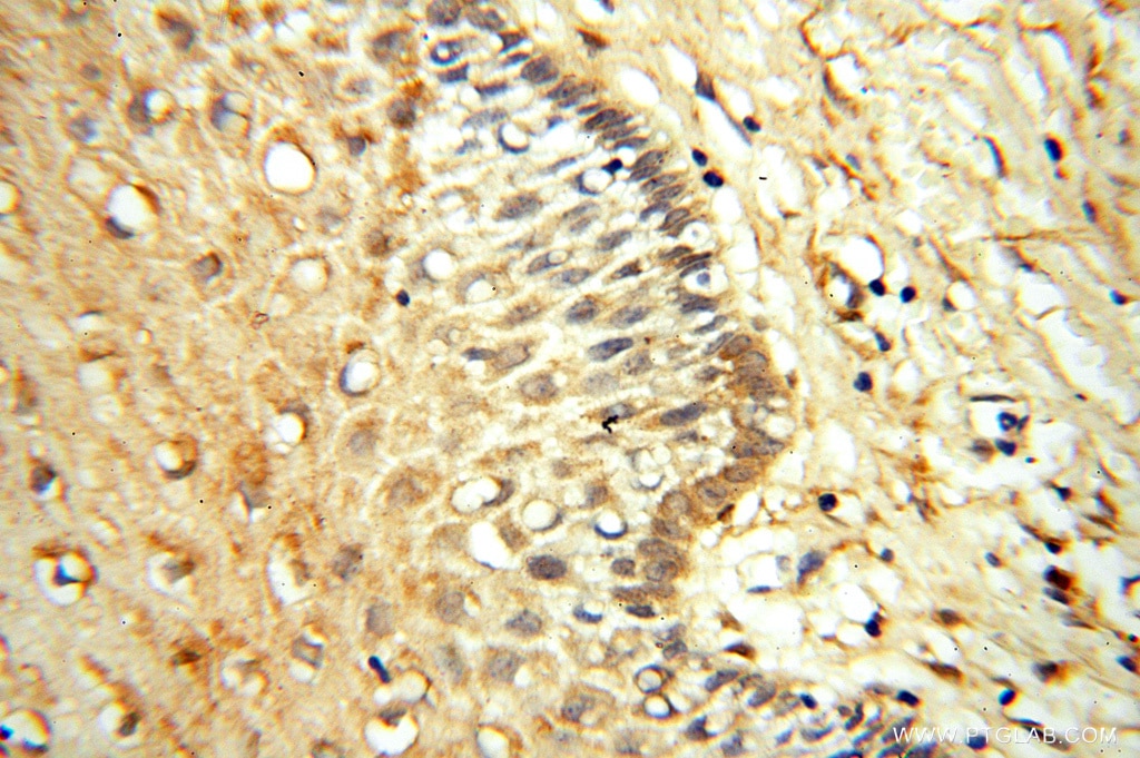 GSTM4 IHC Immunohistochemical 16766-1-AP GSTM4 Antibody GSTM4-4; GTM4; MGC131945; MGC9247