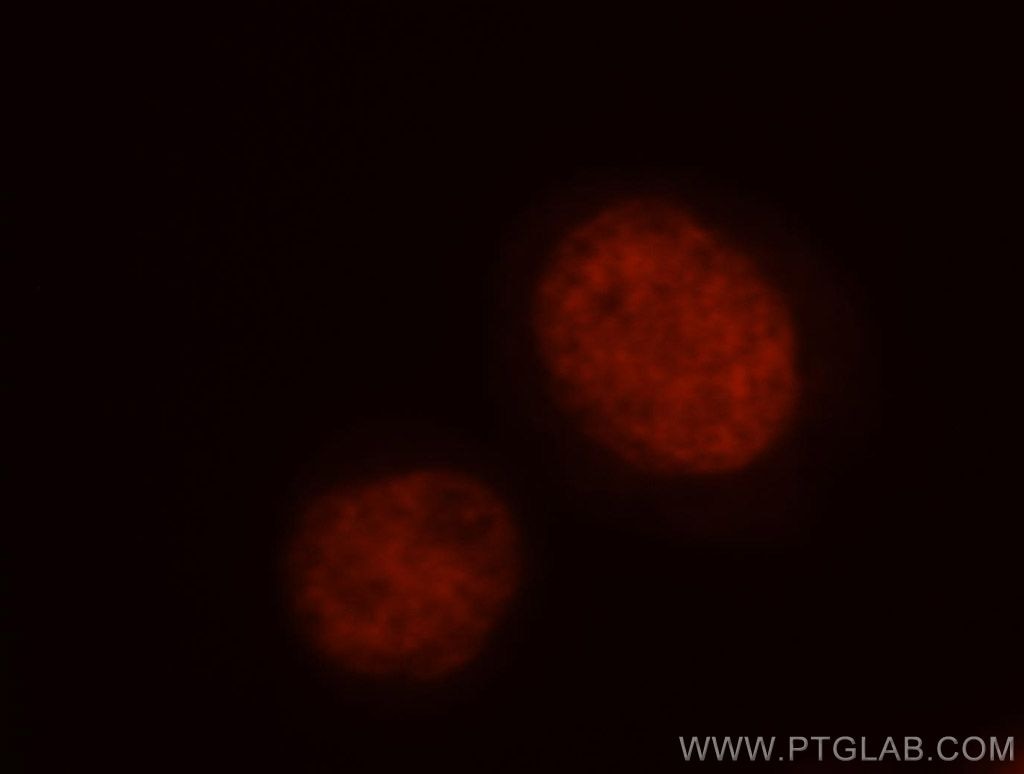 Immunofluorescent analysis of Hela cells, using GTF2I antibody 10499-1-AP at 1:50 dilution and Rhodamine-labeled goat anti-rabbit IgG (red). GTF2I Immunofluorescence IF 10499-1-AP GTF2I Antibody BAP-135; BAP135; BTKAP1; DIWS; FLJ38776; FLJ56355; IB291; SPIN; TFII-I; WBS; WBSCR6