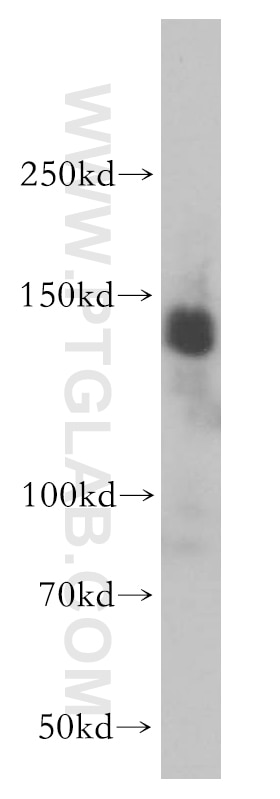 HEK-293 cells were subjected to SDS PAGE followed by western blot with 10499-1-AP(GTF2I Antibody) at dilution of 1:800 GTF2I western blot WB 10499-1-AP GTF2I Antibody BAP-135; BAP135; BTKAP1; DIWS; FLJ38776; FLJ56355; IB291; SPIN; TFII-I; WBS; WBSCR6
