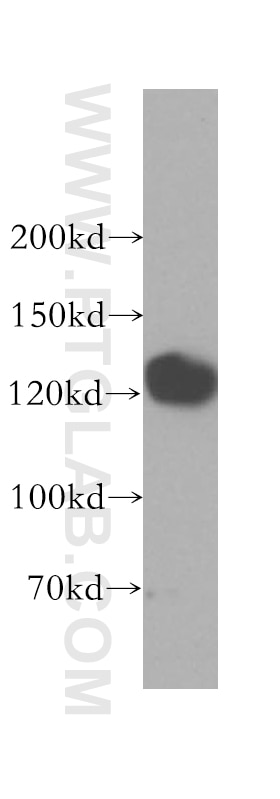 GTF2IRD1 western blot WB 17052-1-AP GTF2IRD1 Antibody BEN; CREAM1; GTF3; MUSTRD1; RBAP2; WBS; WBSCR11; WBSCR12; hMusTRD1alpha1