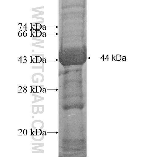 GTPBP5 fusion protein ag14424 SDS-PAGE
