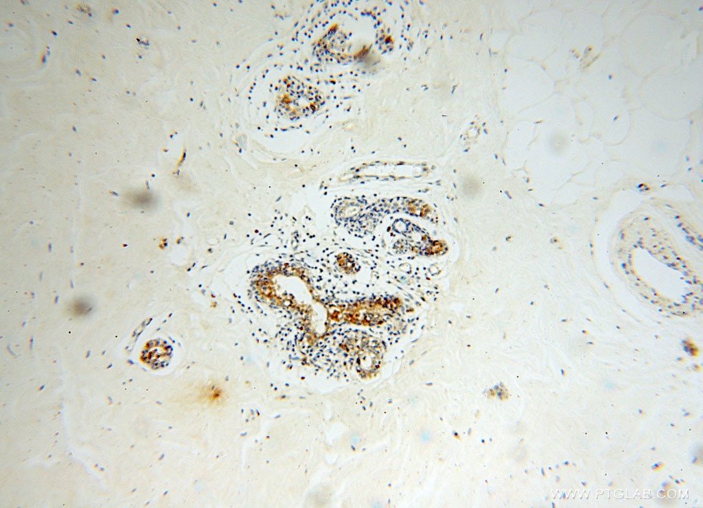 GUSB IHC Immunohistochemical 16332-1-AP GUSB Antibody FLJ39445; MPS7