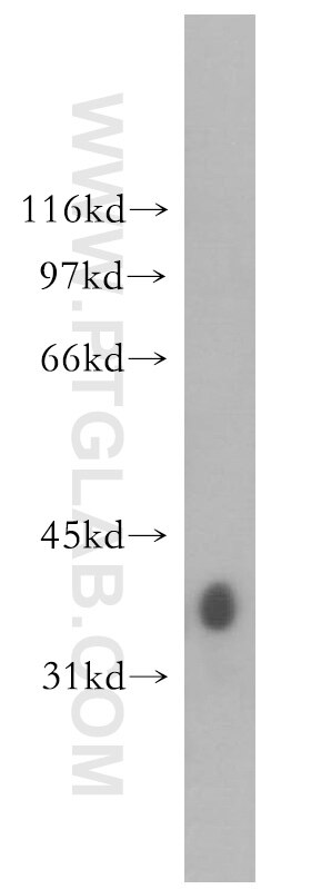 GYG1 western blot WB 12836-1-AP GYG1 Antibody GYG