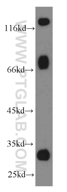 Galc western blot WB 11991-1-AP Galc Antibody 2310068B06Rik; A930008M05Rik; AW212969; AW413532; Gacy; twi; twitcher