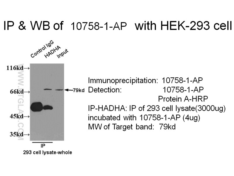 HADHA IP 10758-1-AP HADHA Antibody ECHA; GBP; HADH; LCHAD; MGC1728; MTPA; TP-ALPHA