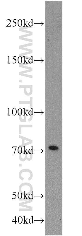 HADHA western blot WB 10758-1-AP HADHA Antibody ECHA; GBP; HADH; LCHAD; MGC1728; MTPA; TP-ALPHA