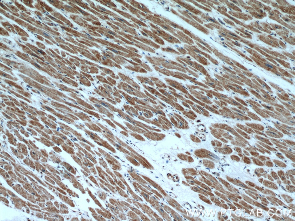 HCN2 IHC Immunohistochemical 55245-1-AP HCN2 Antibody BCNG-2; BCNG2; HAC-1