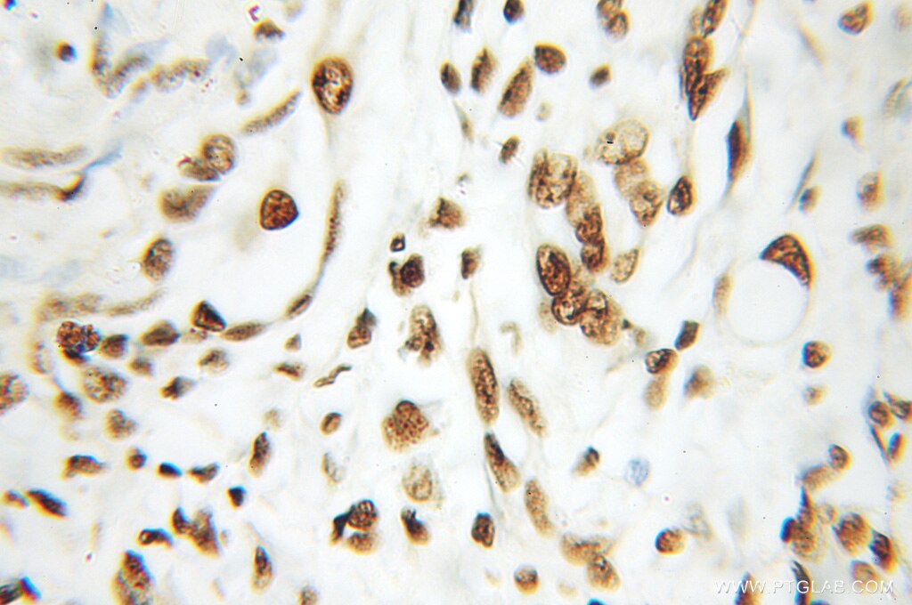 HDAC1 IHC Immunohistochemical 10197-1-AP HDAC1 Antibody DKFZp686H12203; GON-10; HD1; RPD3; RPD3L1