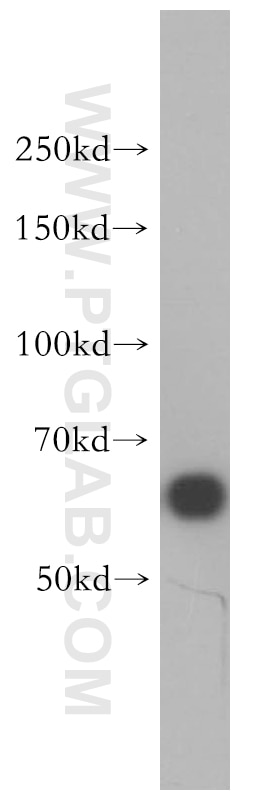 HDAC1 western blot WB 10197-1-AP HDAC1 Antibody DKFZp686H12203; GON-10; HD1; RPD3; RPD3L1