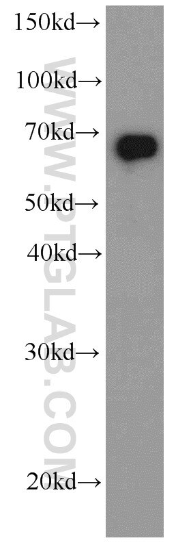 HDAC1 western blot WB 66085-1-Ig HDAC1 Antibody DKFZp686H12203; GON-10; HD1; RPD3; RPD3L1