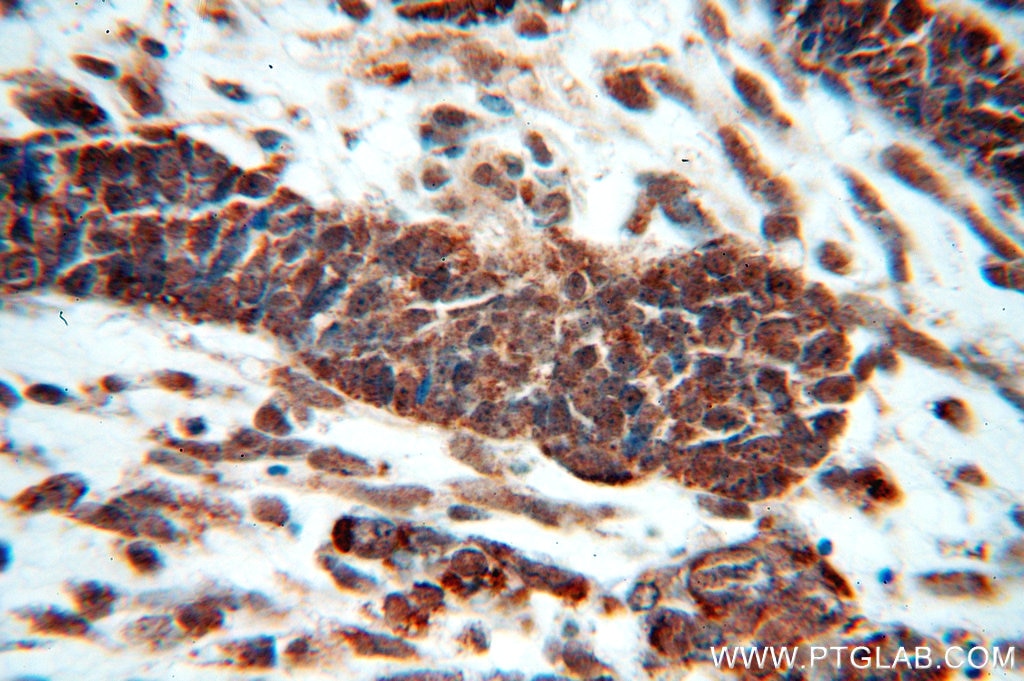 HDAC3 IHC Immunohistochemical 10255-1-AP HDAC3 Antibody HD3; RPD3; RPD3-2