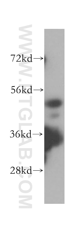HL-60 cells were subjected to SDS PAGE followed by western blot with 16164-1-AP(HDAC3-specific Antibody) at dilution of 1:500 HDAC3-specific western blot WB 16164-1-AP HDAC3-specific Antibody HD3; RPD3; RPD3-2