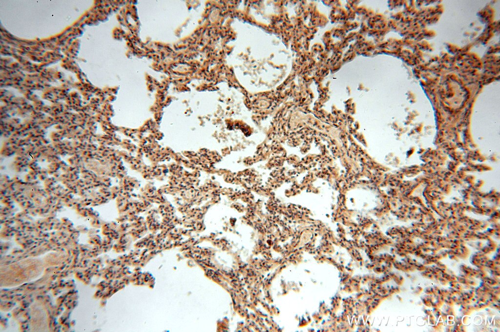 HDAC4-specific IHC Immunohistochemical 16165-1-AP HDAC4-specific Antibody HA6116; HD4; HDAC-A; HDACA; KIAA0288