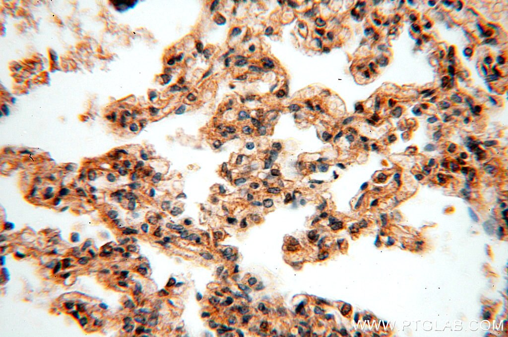 HDAC4-specific IHC Immunohistochemical 16165-1-AP HDAC4-specific Antibody HA6116; HD4; HDAC-A; HDACA; KIAA0288