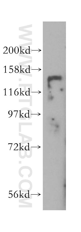 HDAC4-specific western blot WB 16165-1-AP HDAC4-specific Antibody HA6116; HD4; HDAC-A; HDACA; KIAA0288
