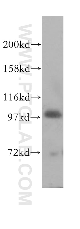 MCF7 cells were subjected to SDS PAGE followed by western blot with 11487-1-AP(HECTD3 Antibody) at dilution of 1:1000 HECTD3 western blot WB 11487-1-AP HECTD3 Antibody FLJ21156; FLJ31983; MGC161630; RP11-69J16.1