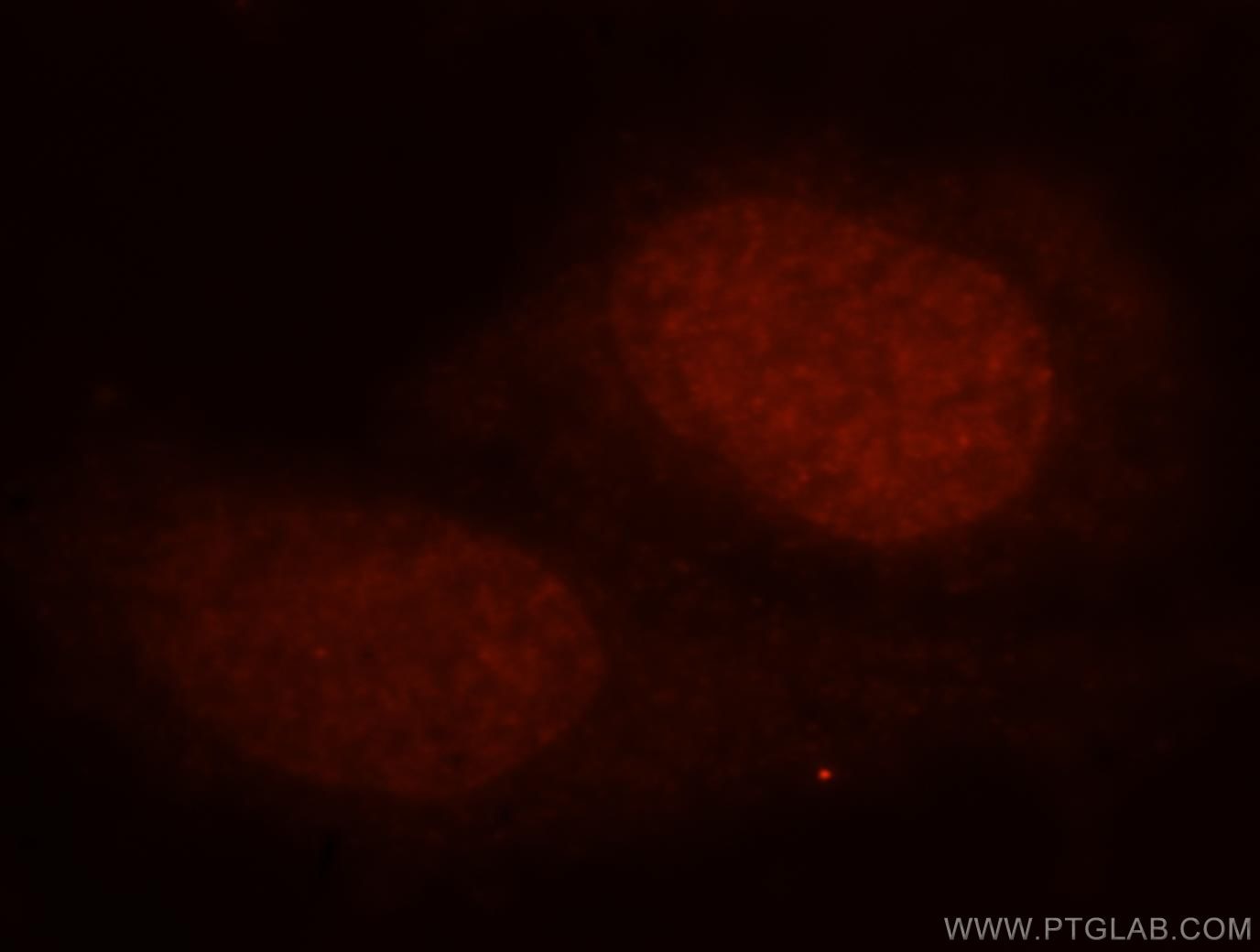 HEXIM1 Immunofluorescence IF 15676-1-AP HEXIM1 Antibody CLP1; EDG1; FLJ13562; HIS1; MAQ1