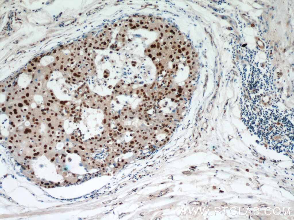 HEXIM1 IHC Immunohistochemical 15676-1-AP HEXIM1 Antibody CLP1; EDG1; FLJ13562; HIS1; MAQ1