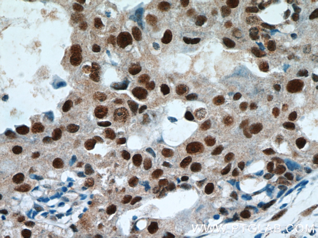 HEXIM1 IHC Immunohistochemical 15676-1-AP HEXIM1 Antibody CLP1; EDG1; FLJ13562; HIS1; MAQ1