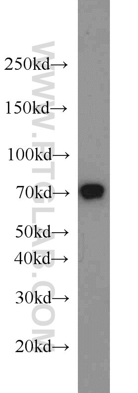 HEXIM1 western blot WB 15676-1-AP HEXIM1 Antibody CLP1; EDG1; FLJ13562; HIS1; MAQ1