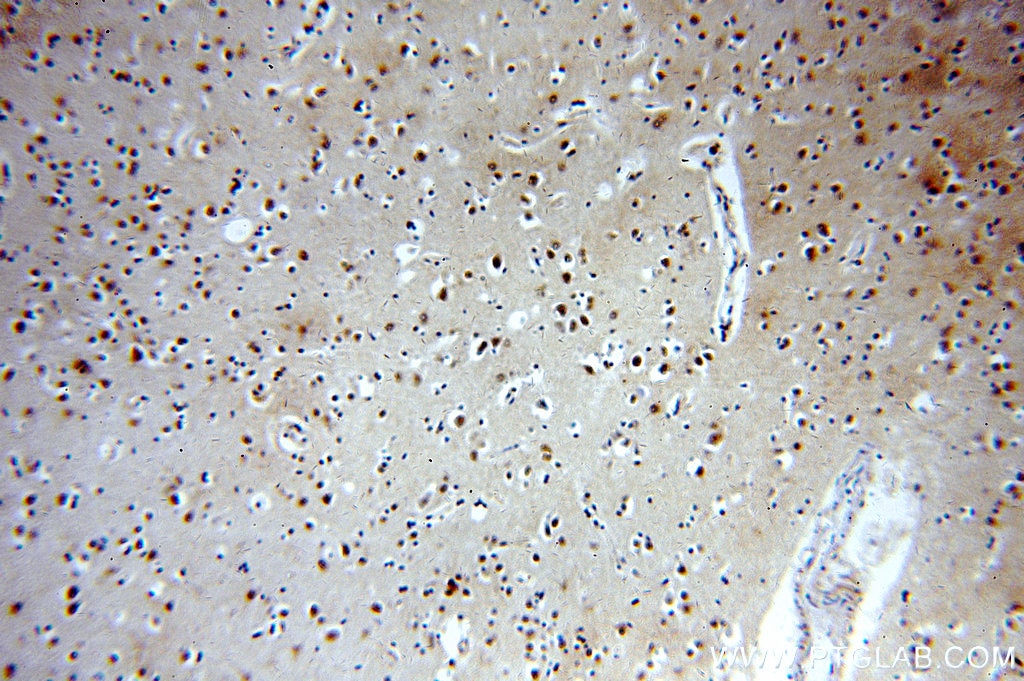 HIP1-Specific IHC Immunohistochemical 19688-1-AP HIP1-Specific Antibody ILWEQ; MGC126506