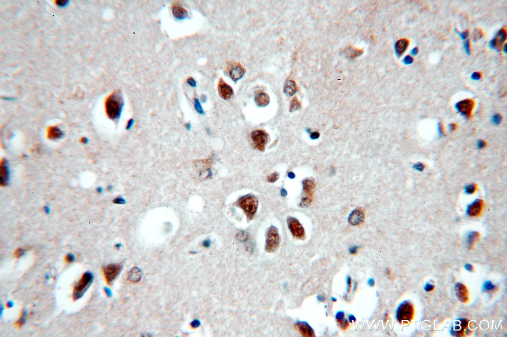 HIP1-Specific IHC Immunohistochemical 19688-1-AP HIP1-Specific Antibody ILWEQ; MGC126506