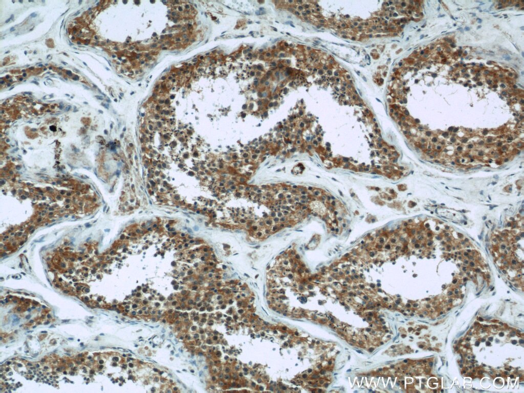 HK1 IHC Immunohistochemical 19662-1-AP HK1 Antibody HK1-ta; HK1-tb; HK1-tc; HKI; HXK1