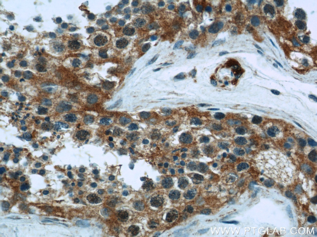 HK1 IHC Immunohistochemical 19662-1-AP HK1 Antibody HK1-ta; HK1-tb; HK1-tc; HKI; HXK1