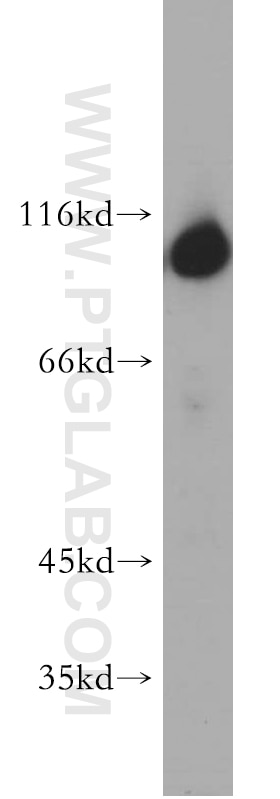 HK1 western blot WB 19662-1-AP HK1 Antibody HK1-ta; HK1-tb; HK1-tc; HKI; HXK1