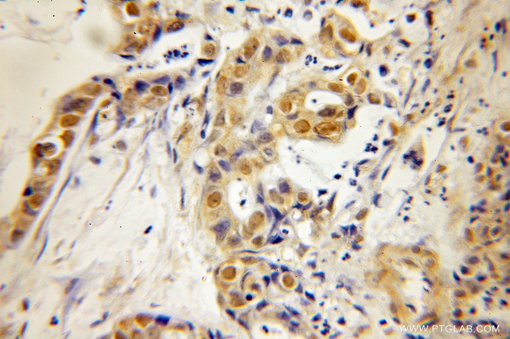 HMG20A IHC Immunohistochemical 12085-2-AP HMG20A Antibody FLJ10739; HMGX1; HMGXB1