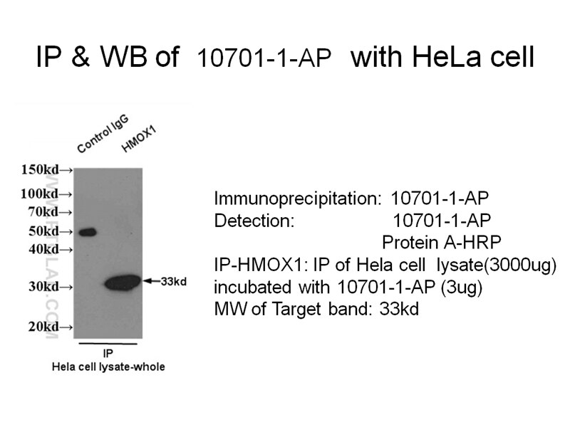 IP result of HMOX1 antibody (10701-1-AP for IP and Detection) with HeLa cell lysate. HMOX1 IP 10701-1-AP HMOX1 Antibody HO-1; HSP32; bK286B10