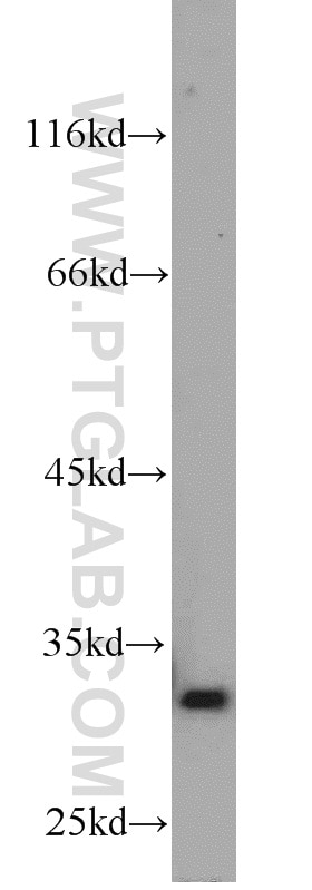 mouse liver tissue were subjected to SDS PAGE followed by western blot with 10701-1-AP(HMOX1 Antibody) at dilution of 1:600 HMOX1 western blot WB 10701-1-AP HMOX1 Antibody HO-1; HSP32; bK286B10