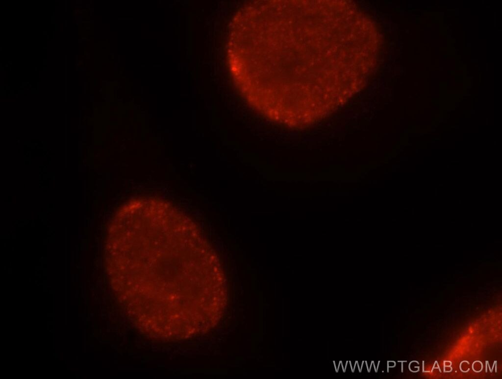 HNRNPC Immunofluorescence IF 11760-1-AP HNRNPC Antibody C1; C2; HNRNP; HNRPC; MGC104306; MGC105117; MGC117353; MGC131677; SNRPC