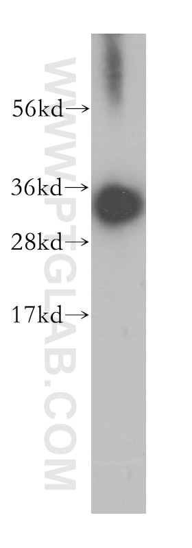HNRNPC western blot WB 11760-1-AP HNRNPC Antibody C1; C2; HNRNP; HNRPC; MGC104306; MGC105117; MGC117353; MGC131677; SNRPC